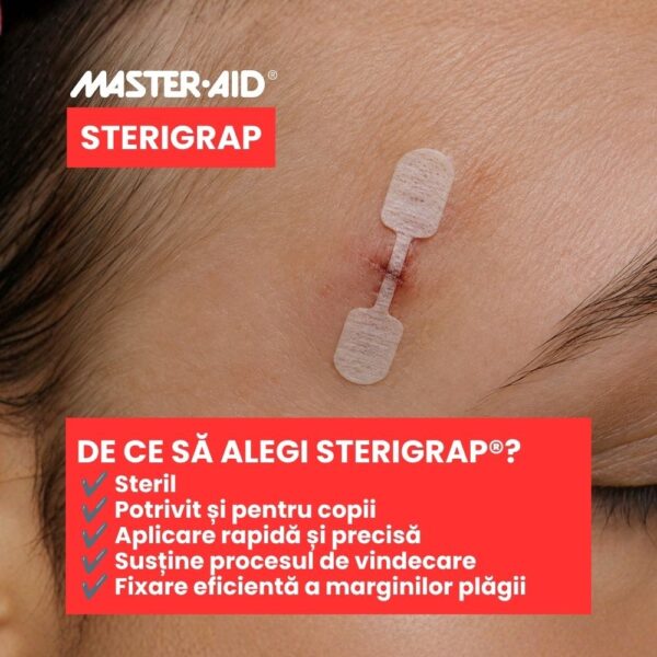 plasture-steril-suturare-fata-sterigrap-32x8mm-10-bucati-master-aid-O34387-farmacia-morpheus-1 Plasture Steril Suturare Fata Sterigrap, 32x8mm, 10 Bucati, Master-Aid