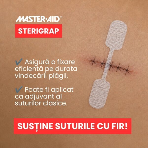 plasture-steril-suturare-fata-sterigrap-32x8mm-10-bucati-master-aid-O34387-farmacia-morpheus-2 Plasture Steril Suturare Fata Sterigrap, 32x8mm, 10 Bucati, Master-Aid