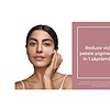 Reducere vizibil pete pigmentare în 1 săptămână la Farmacia Morpheus.